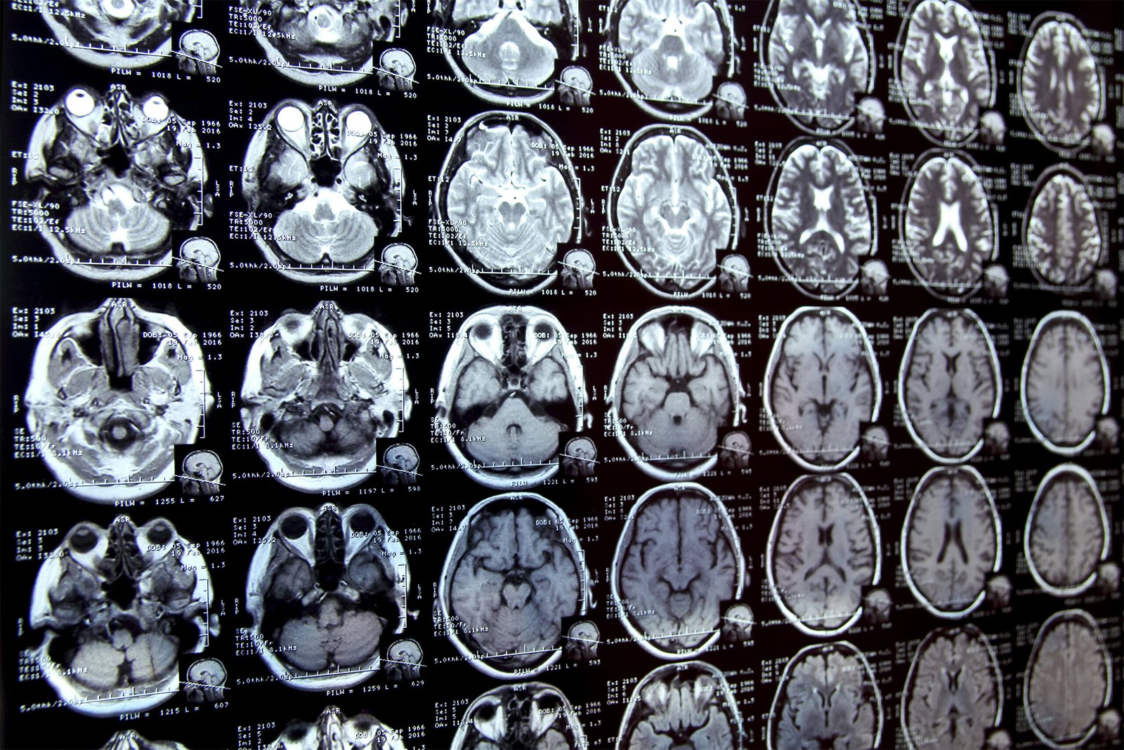 New AI system could accelerate clinical research